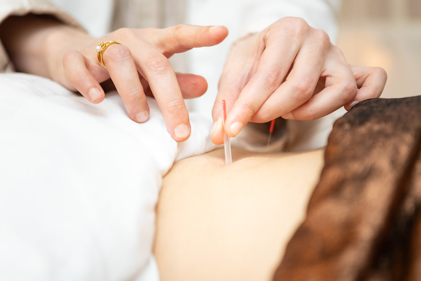 Acupuncture, Massage & Cupping/Hijama by Mahdiyah Asiya Integrative Medicine